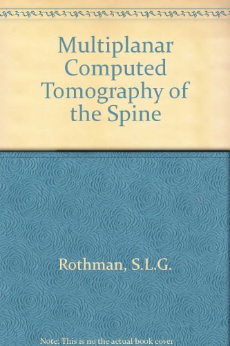 Beispielbild fr Multiplanar CT Of The Spine zum Verkauf von Better World Books