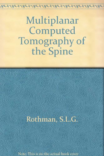 9780839119104: Multiplanar Computed Tomography of the Spine
