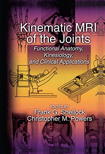 Imagen de archivo de Kinematic MRI of the Joints: Functional Anatomy, Kinesiology, and Clinical Applications a la venta por WeBuyBooks