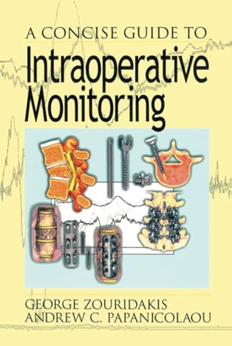 Beispielbild fr A Concise Guide to Intraoperative Monitoring zum Verkauf von Chiron Media