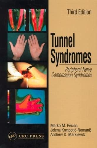 9780849309526: Tunnel Syndromes