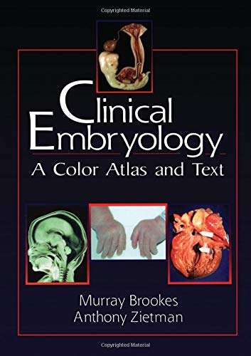 9780849312557: Clinical Embryology: A Color Atlas and Text