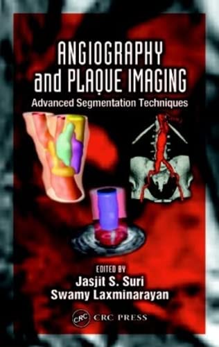 Imagen de archivo de Angiography and Plaque Imaging: Advanced Segmentation Techniques (Biomedical Engineering) a la venta por Big River Books
