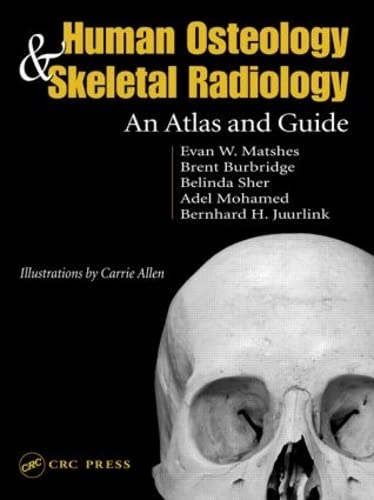 9780849319013: Human Osteology and Skeletal Radiology: An Atlas and Guide