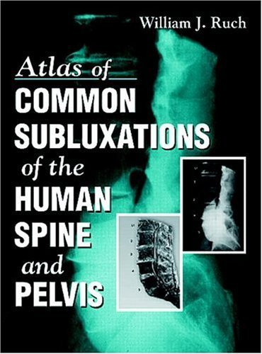9780849331176: Atlas of Common Subluxations of the Human Spine and Pelvis