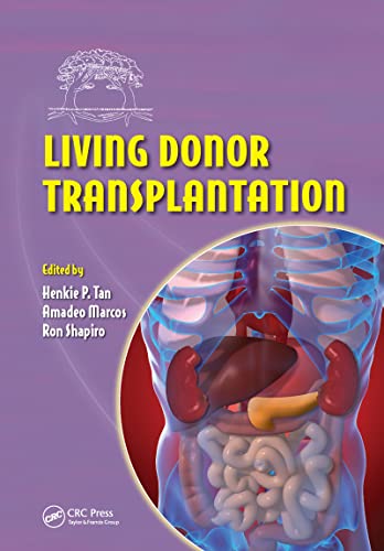 9780849337666: Living Donor Transplantation