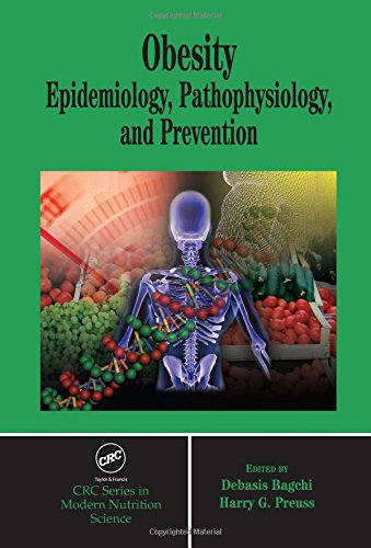 Imagen de archivo de Obesity: Epidemiology, Pathophysiology, and Prevention (CRC Press series in Modern Nutrition Science) a la venta por SecondSale