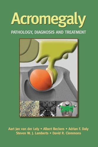 Beispielbild fr Acromegaly: Pathology, Diagnosis and Treatment zum Verkauf von medimops