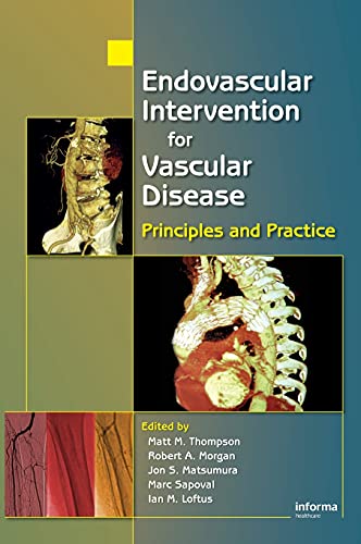 9780849339790: Endovascular Intervention for Vascular Disease: Principles and Practice