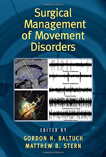 Surgical Management of Movement Disorders (Neurological Disease and Therapy) (9780849353130) by Matthew B. Stern Gordon H. Baltuch; Matthew B. Stern