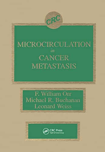 Stock image for Microcirculation in Cancer Metastasis for sale by Book Bear