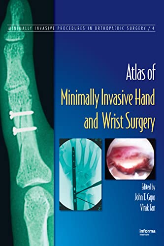 9780849370144: Atlas of Minimally Invasive Hand and Wrist Surgery