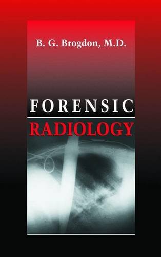 Stock image for Forensic Radiology for sale by HPB-Red
