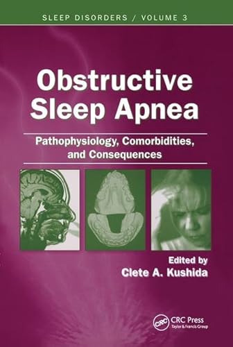 9780849391804: Obstructive Sleep Apnea: Pathophysiology, Comorbidities and Consequences: Pathophysiology, Comorbidities, and Consequences (Sleep Disorders)