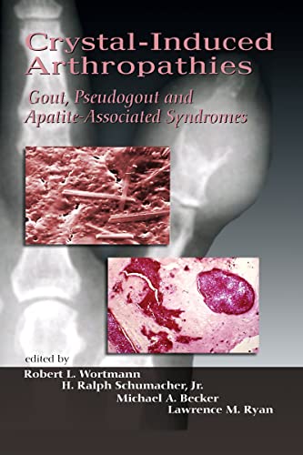 Imagen de archivo de Crystal-Induced Arthropathies: Gout, Pseudogout And Apatite-Associated Syndromes a la venta por Revaluation Books
