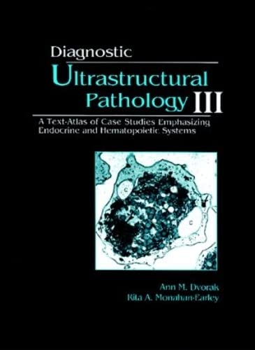 Diagnostic Ultrastructural Pathology III A TextAtlas of Case Studies Emphasizing Endocrine and Hematopoietic Systems: Volume III (9780849394744) by Ann M. Dvorak; Rita A. Monahan-Earley