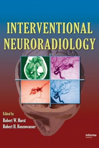 9780849395628: Interventional Neuroradiology