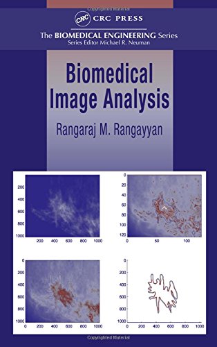 Imagen de archivo de Biomedical Image Analysis (Biomedical Engineering) a la venta por Phatpocket Limited