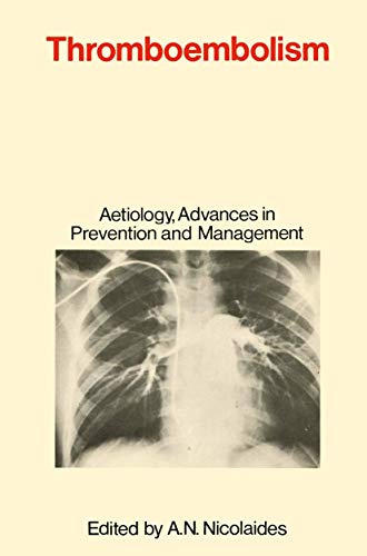 Beispielbild fr Thromboembolism: Aetiology, Advances in Prevention and Management zum Verkauf von Anybook.com
