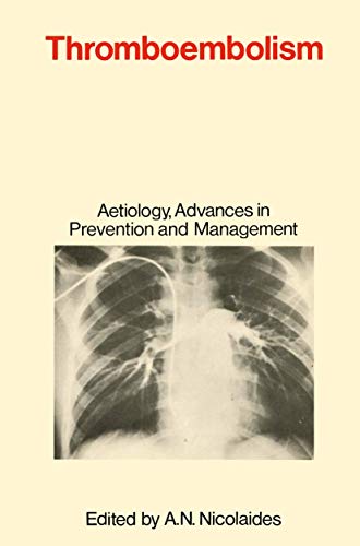 Stock image for Thromboembolism: Aetiology, Advances in Prevention and Management for sale by Anybook.com