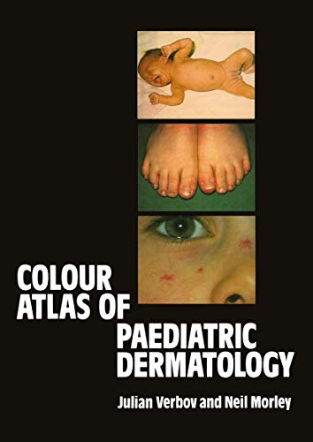 Stock image for Colour Atlas of Paediatric Dermatology. for sale by The Blue Penguin