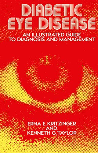 Beispielbild fr Diabetic Eye Disease: An Illustrated Guide to Diagnosis and Management zum Verkauf von PsychoBabel & Skoob Books