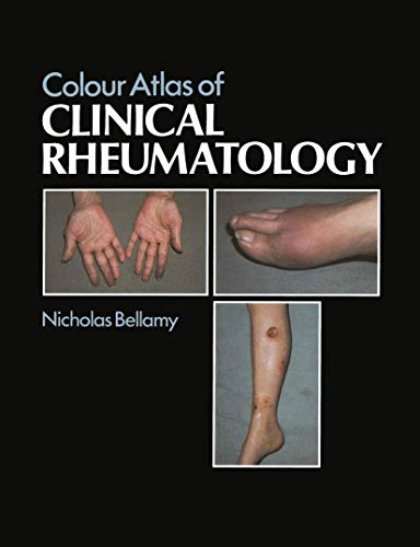 Beispielbild fr Colour Atlas of Clinical Rheumatology zum Verkauf von WorldofBooks