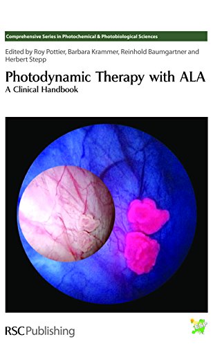 PHOTODYNAMIC THERAPY WITH ALA A CLINICAL HANBOOK