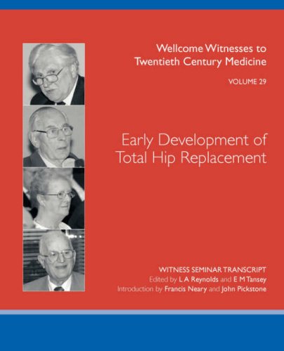 Beispielbild fr Early Development of Total Hip Replacement zum Verkauf von Jackson Books