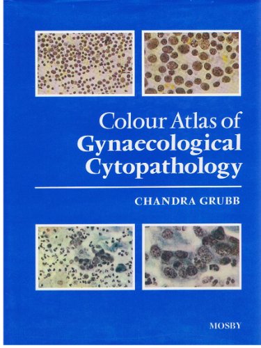 Stock image for Colour Atlas of Gynaecological Cytopathology for sale by HPB-Red