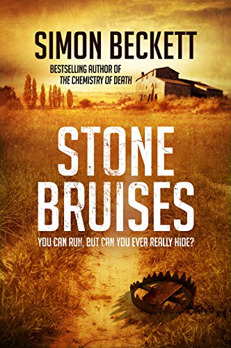 9780857502582: Stone Bruises