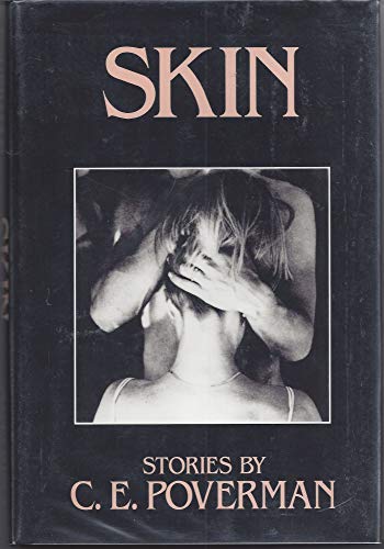 Beispielbild fr Skin: Stories zum Verkauf von Redux Books