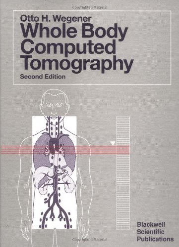 Beispielbild fr Whole-Body Computed Tomography zum Verkauf von Better World Books Ltd