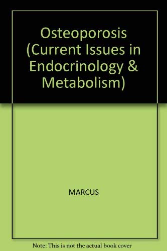 9780865422667: Osteoporosis (Current Issues in Endocrinology & Metabolism)
