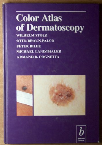 Stock image for Color Atlas of Dermatoscopy for sale by HPB-Red