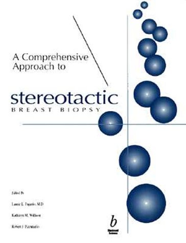 Beispielbild fr A Comprehensive Approach to Stereotactic Breast Biopsy zum Verkauf von Better World Books