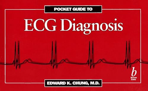 Beispielbild fr Pocket Guide to ECG Diagnosis zum Verkauf von Better World Books