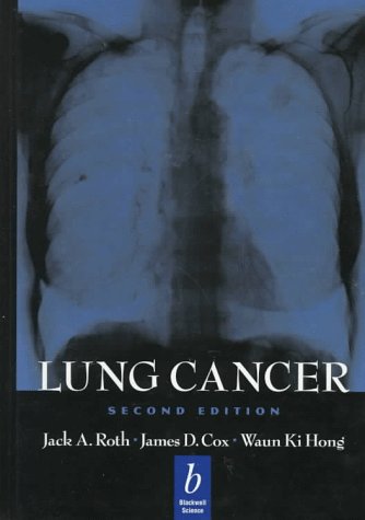 Stock image for Lung Cancer. for sale by Black Cat Hill Books