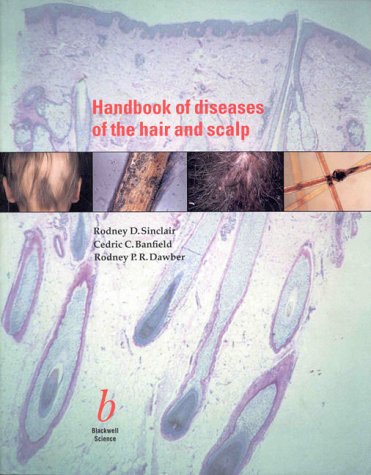 Stock image for Handbook of Diseases of the Hair and Scalp for sale by GoldenDragon