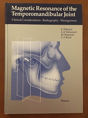9780865773639: Magnetic Resonance of the Temporomandibular Joint Considerations