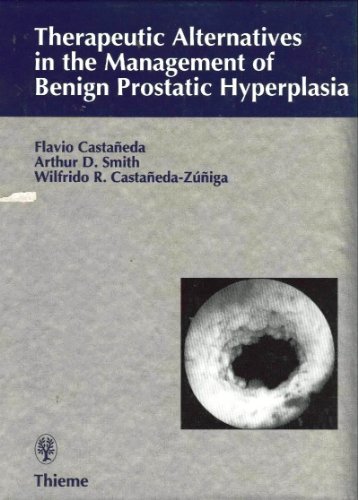 Beispielbild fr Therapeutic Alternatives in the Management of Benign Prostatic-Hyperplasia zum Verkauf von NEPO UG