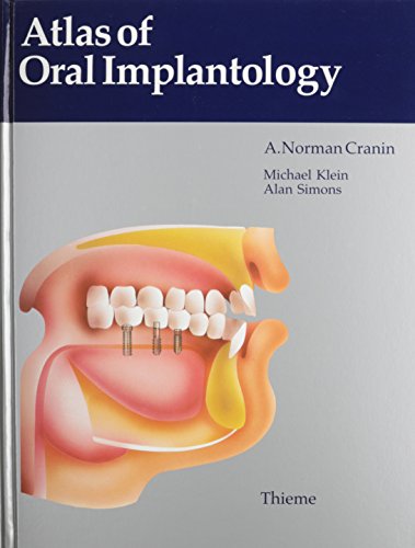 Atlas of Oral Implantology (9780865774490) by Cranin, A. Norman; Klein, M.; Simons, Alan