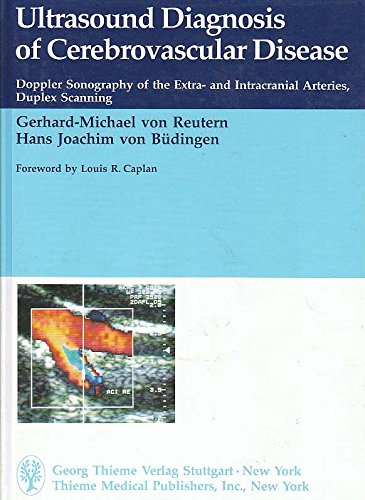 9780865774575: Ultrasound Diagnosis of Cerebrovascular Disease: Doppler Sonography of the Extra- And Intracranial Arteries Duplex Scanning