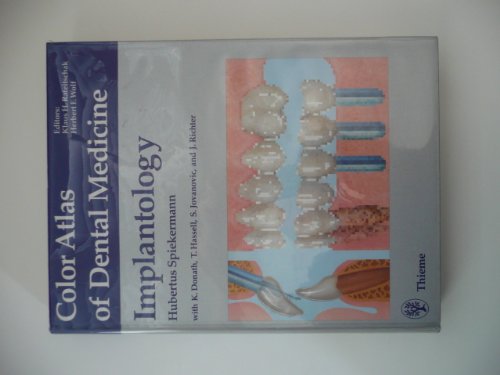 Stock image for Implantology for sale by ThriftBooks-Dallas
