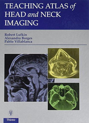 Imagen de archivo de Teaching Atlas of Head and Neck Imaging a la venta por HPB-Red