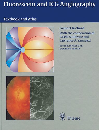 Imagen de archivo de Fluorescein and ICG Angiography: Textbook and Atlas a la venta por dsmbooks