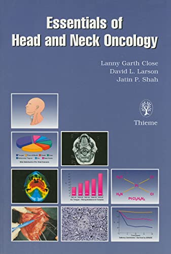 Stock image for Essentials of Head and Neck Oncology for sale by Bestsellersuk