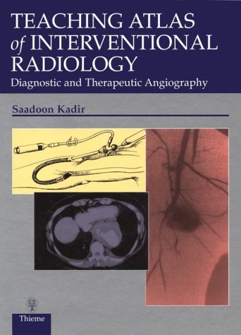 Imagen de archivo de Teaching Atlas of Interventional Radiology: Diagnostic and Therapeutic Angiography a la venta por HPB-Red