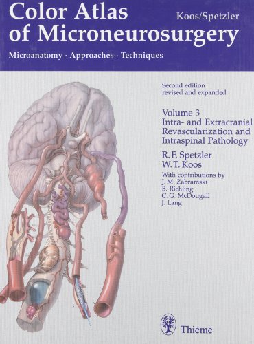 Color Atlas of Microneurosurgery: Intra- Und Extracranial Revascularization and Intraspinal Pathology: Microanatomy, Approaches and Techniques: 3 (9780865777804) by Koos, W.; Spetzler, Robert F.; Lang, Johannes; Zabramski, J. M.; Richling, B.; Zabramski, Joseph M.