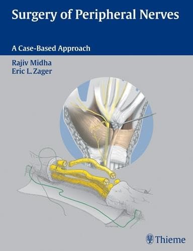 9780865778603: Surgery of Peripheral Nerves: A Case-Based Approach